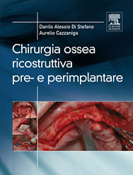 Chirurgia ossea ricostruttiva pre-e perimplantare